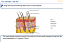 The skin | Recurso educativo 26948