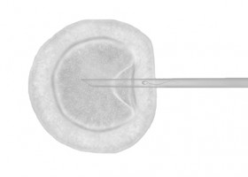 IVI- Reproduccion asistida, fertilidad, inseminacion, fecundacion invitro | Recurso educativo 731535